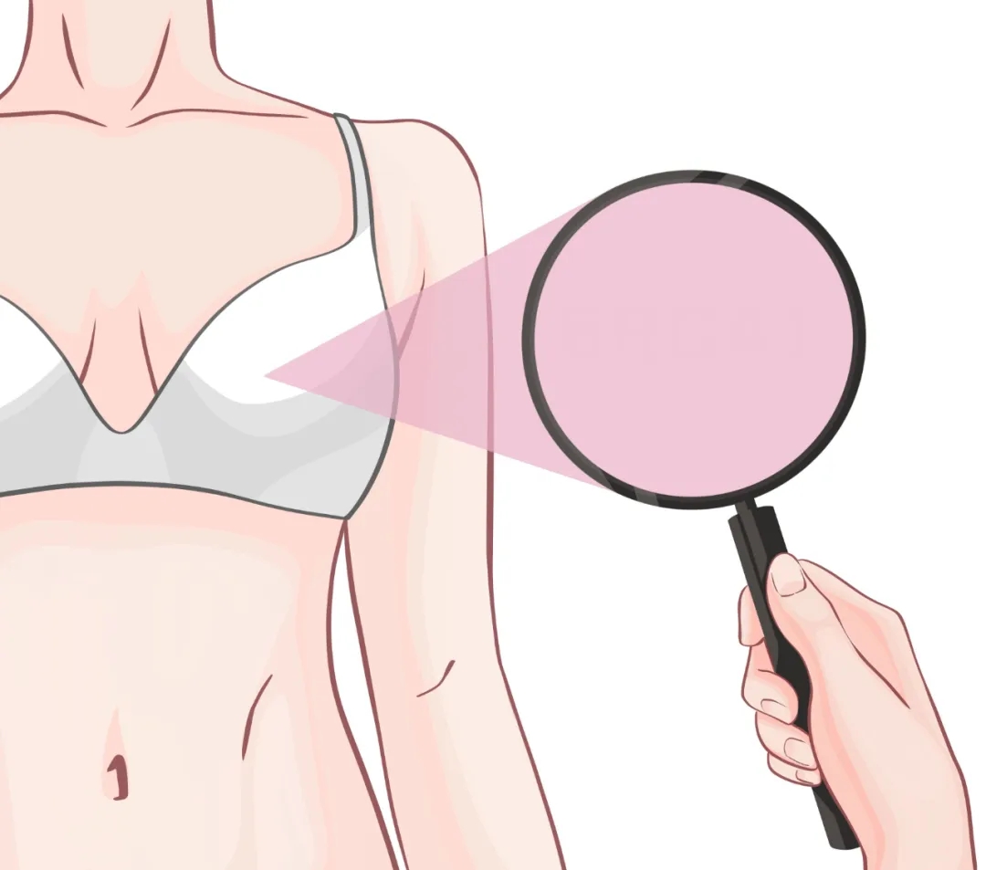 切莫盲目丰胸！一不小心陷误区！