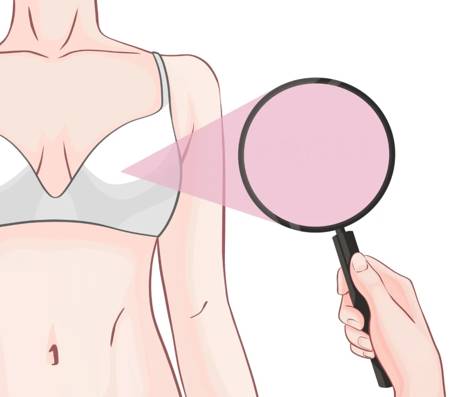 乳腺癌可防可治，建议收藏反复阅读！