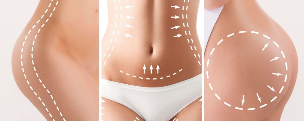 生物补片丰胸效果待检验