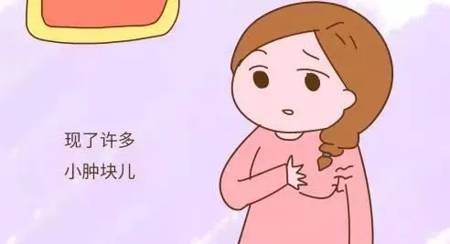 乳房肿块哪些事儿