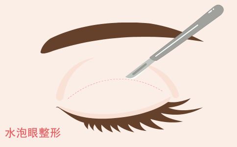 偶买噶！注射隆胸的风险居然是这个