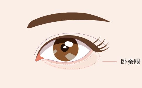 注射隆胸术前准备要做好