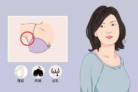 什么是副乳？我该怎么办？