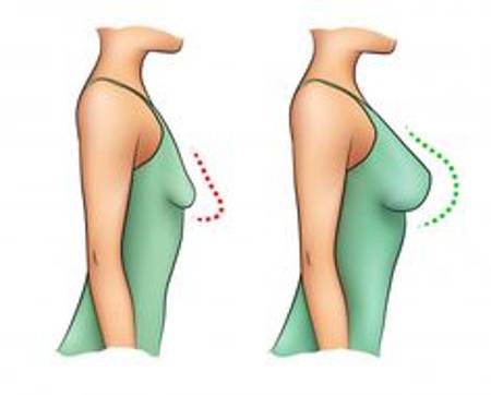 新发现？催眠能让胸部变大？