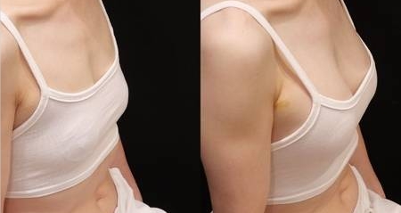 学会这些就能丰胸美乳？你试过吗？