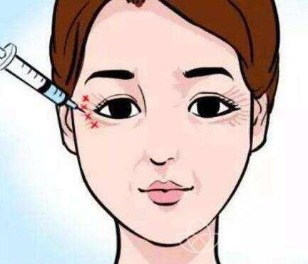 注射*的副作用有哪些?