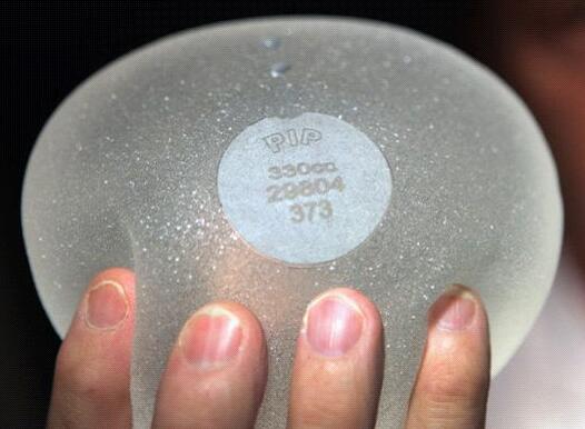 北京丰胸假体取出多少钱？