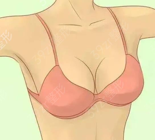 隆胸的手感与术后护理有关吗？对隆胸假体的寿命有什么影响？