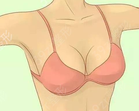 隆胸后拆线痛吗？广州万和蓝贝假体隆胸怎么样？