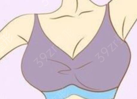 脂肪丰胸整形多少钱（脂肪丰胸整形的价格）