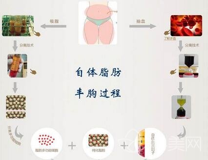 自体脂肪丰胸后疼多久才能恢复啊？