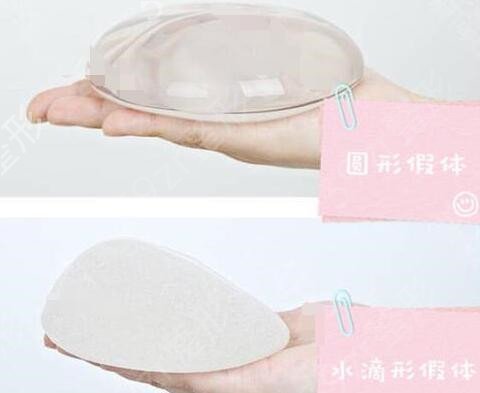 假体隆胸应该怎么?。渴屎夏男┤巳?？