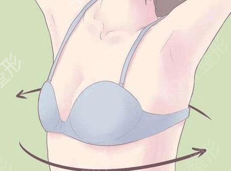 抽脂肪丰胸大概要用多少钱（抽脂肪丰胸手术费用）
