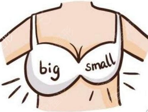 你适合做‘隆乳术’吗