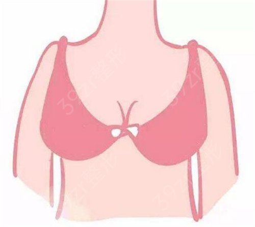 自体脂肪丰胸再次挺拔日记：来自宝妈的心路历程自述