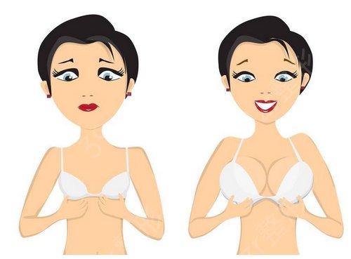 玻尿酸注射隆胸果好吗？