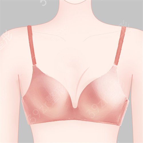 丰胸手术痛吗？