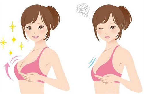 曼托假体隆胸后遗症有哪些？