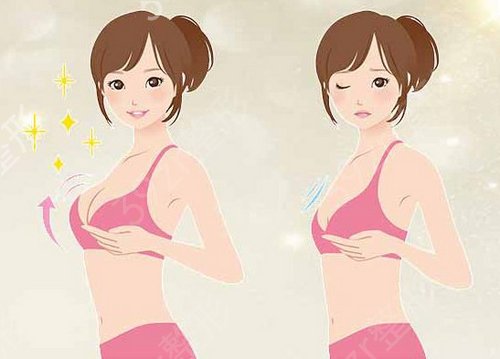 　妙桃假体丰胸让我成为了真正的气质美女，再也不用垫胸垫了