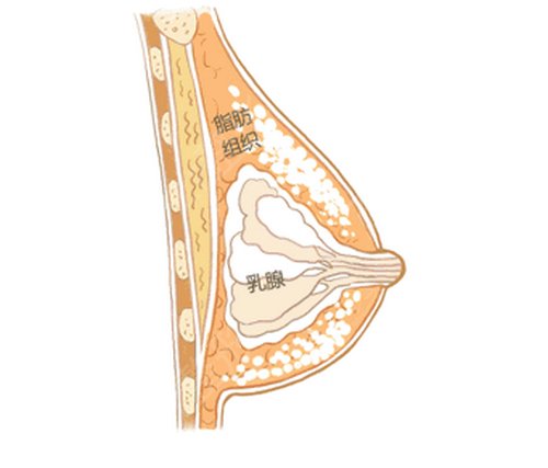 隆胸假体取出后怎么保养？