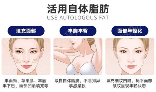 想变身性感女神?自体脂肪隆胸把你梦想!