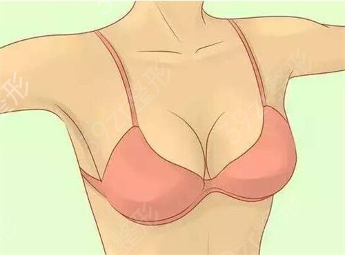 假体隆胸的*度高吗？隆胸假体应该怎么?。? title=