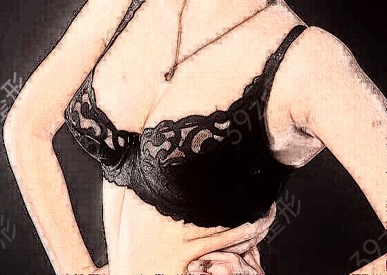 自体脂肪隆胸二次多少?影响成本的因素有哪些?