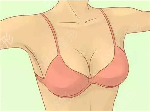 自体脂肪隆胸怎么样？术后注意事项及手术可能存在的副作用同步呈现