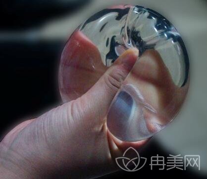 妙桃琴面假体隆胸一般多少钱?*果好吗?值不值得做?