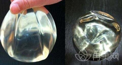 国产的隆胸假体哪种好？产品推荐