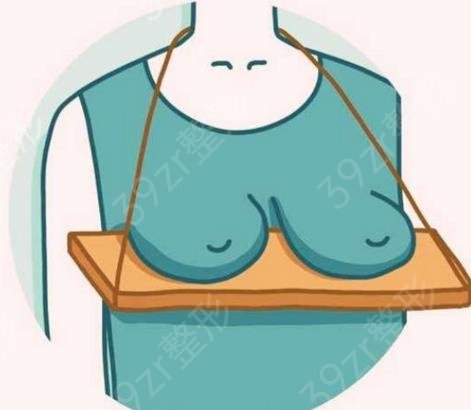 脂肪填充胸部和假体哪个好？用脂肪填充胸部还是用假体