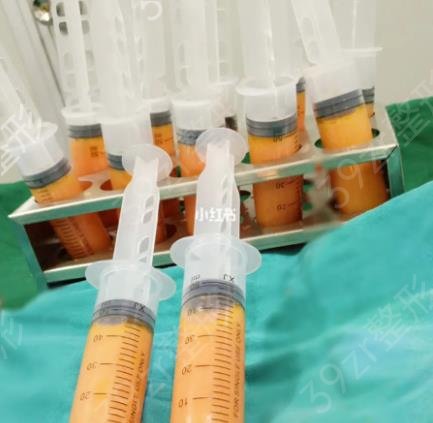 脂肪填充胸部价格，揭秘脂肪填充胸部价格的因素