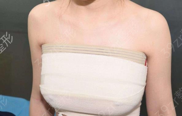 脂肪填充胸部可以维持多久时间？脂肪填充胸部的维持时间有多长