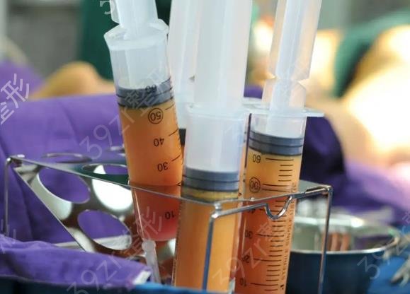 脂肪填充胸部后遗症，脂肪填充胸部后遗症你知道都有哪些吗