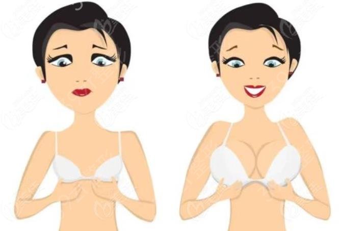 自体脂肪填充胸部有什么危害？关于自体脂肪填充胸部的危害