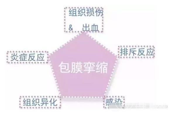 为什么你做假体隆胸会出现失败？当失败了我们怎么办?